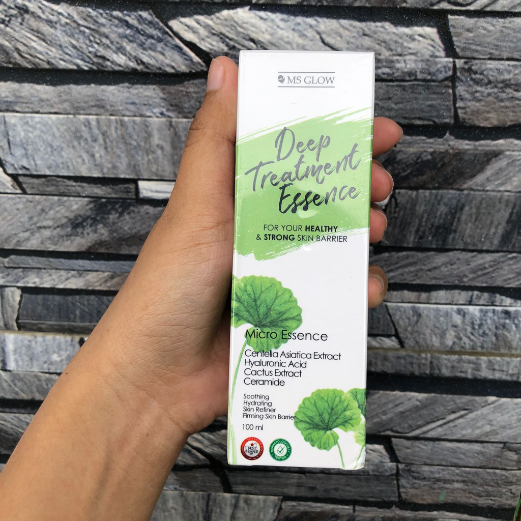 id-11134207-7qukz-lioo8y5s74ksed